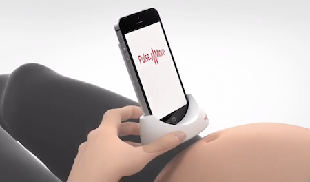 Портативный УЗИ сканер PulseNmore: ультразвуковое сканирование в домашних условиях для контроля беременности